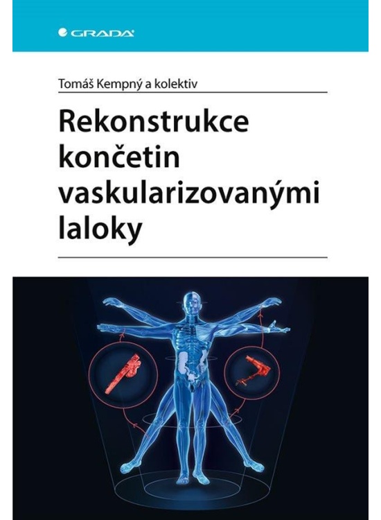 Rekonstrukce končetin vaskularizovanými laloky GRADA Publishing, a. s.