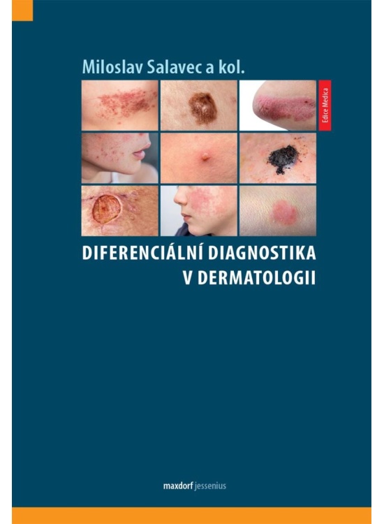 Diferenciální diagnostika v dermatologii Maxdorf s.r.o.