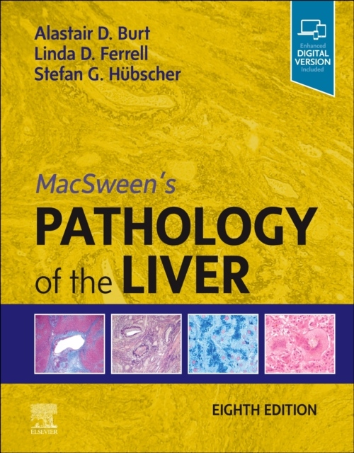 MacSween´s Pathology of the Liver, 8th Edition Elsevier