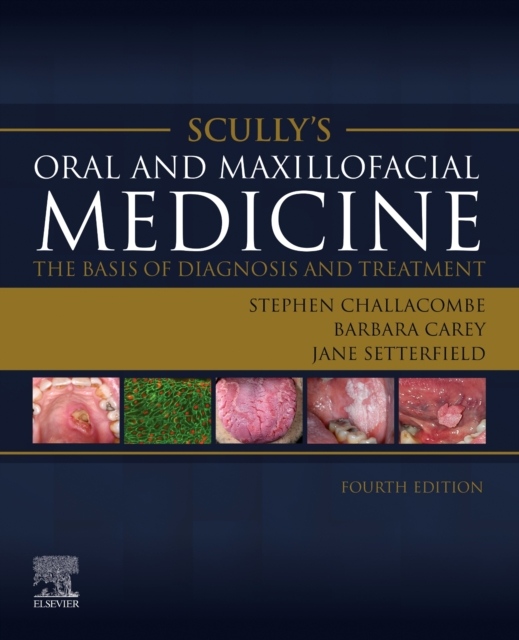 Scully’s Oral and Maxillofacial Medicine: The Basis of Diagnosis and Treatment, The Basis of Diagnosis and Treatment, 4th Edition Elsevier