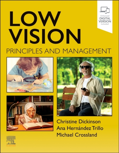 Low Vision, Principles and Management Elsevier