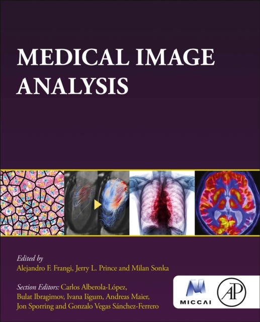 Medical Image Analysis Elsevier