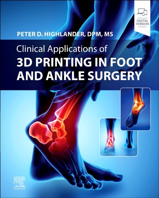 Clinical Applications of 3D Printing in Foot and Ankle Surgery Elsevier