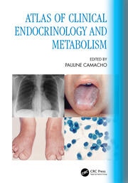 Atlas of Clinical Endocrinology and Metabolism Taylor & Francis Ltd