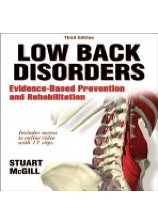 Low Back Disorders, Evidence-Based Prevention and Rehabilitation Human Kinetics Publishers