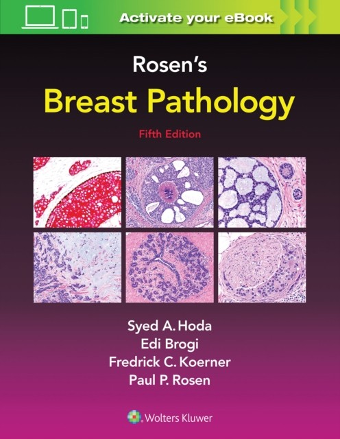 Rosen´s Breast Pathology Lippincott Williams and Wilkins