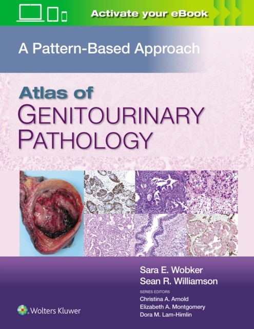 Atlas of Genitourinary Pathology : A Pattern Based Approach Lippincott Williams and Wilkins