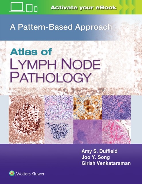 Atlas of Lymph Node Pathology : A Pattern Based Approach Lippincott Williams and Wilkins